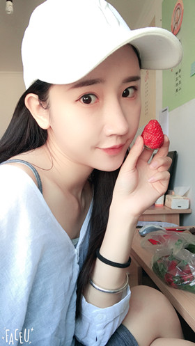 56000元做的自體脂肪填充蘋果肌+太陽穴，大家來看看果怎么樣