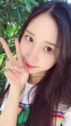 56000元做的自體脂肪填充蘋果肌+太陽穴，大家來看看果怎么樣