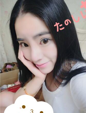 隆鼻整形2個(gè)月恢復(fù)日記 硅膠隆鼻+鼻翼縮小