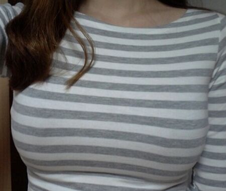 假體隆胸多久能恢復(fù)，親測(cè)兩個(gè)月吧