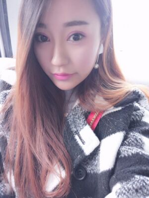 雙眼皮失敗修復(fù)手術(shù)恢復(fù)前后對(duì)比圖