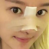 硅膠假體隆鼻過程和隆鼻前后圖片，真實(shí)案例分享