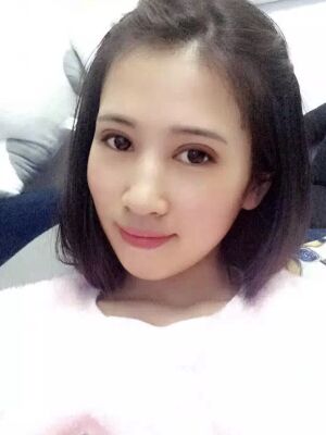 切開雙眼皮恢復(fù)過程，手術(shù)很成功哦