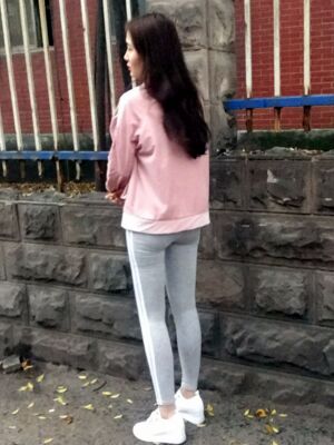 大腿吸脂果超好，腿型好看很多了