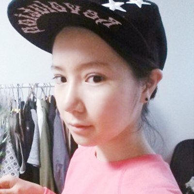 武漢五洲美萊劉楊切開雙眼皮案例