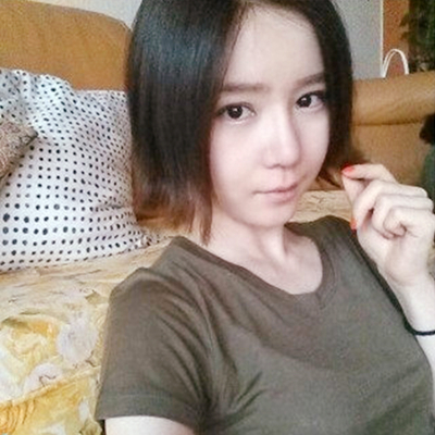 武漢五洲美萊劉楊切開雙眼皮案例