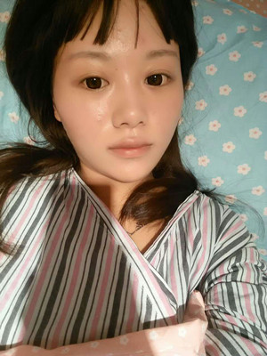 做完自體脂肪豐胸手術(shù)3個(gè)月啦!來看看前后對(duì)比照片哦