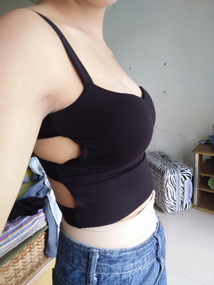 做完自體脂肪豐胸手術(shù)3個(gè)月啦!來看看前后對(duì)比照片哦