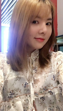 歪鼻矯正+假體隆鼻前后手術(shù)過程圖片分享