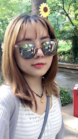 歪鼻矯正+假體隆鼻前后手術(shù)過程圖片分享