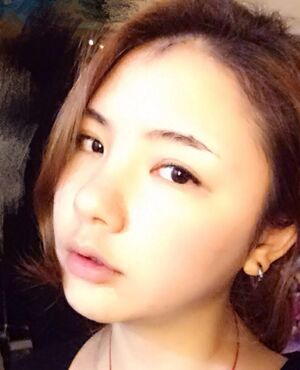 韓式定點(diǎn)雙眼皮前后對(duì)比圖，雙眼有神多了