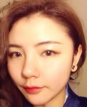 韓式定點(diǎn)雙眼皮前后對(duì)比圖，雙眼有神多了