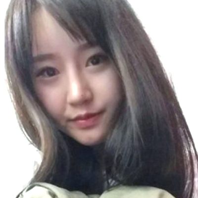 蘇州紫馨孫影玻尿酸隆鼻案例