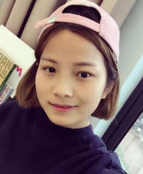 鼻子整形前照片