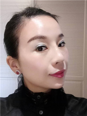 你們來看看我的面部埋埋蛋白線.提升術恢復情況