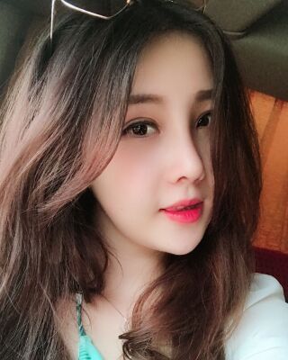 全切雙眼皮+開眼角前后對比照片圖