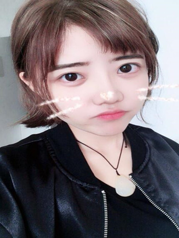 我的隆鼻整形恢復(fù)果圖  塌鼻子逆襲記