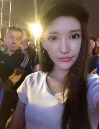 面部面b提升恢復(fù)日記和恢復(fù)圖片，一周左右恢復(fù)自然