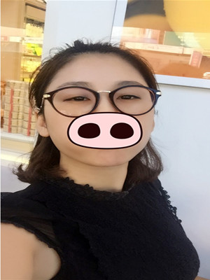 注射瘦臉去眉間紋真實(shí)案例分享——?？诩t妝李科醫(yī)生做的