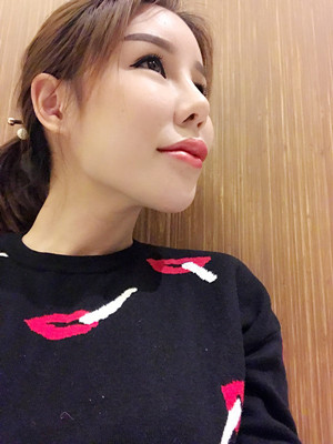 高強(qiáng)度聚焦超聲手術(shù)三個(gè)月的前后恢復(fù)記錄——?？诩t妝李科做的