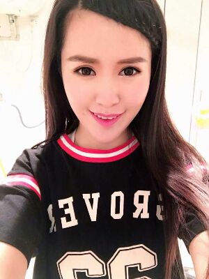 全切雙眼皮修復(fù)恢復(fù)后圖片，寬度較為合適喲