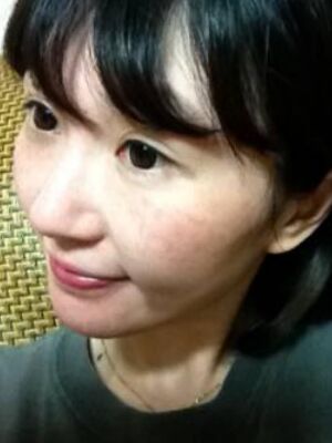 激光去雀斑果好不好，真實案例告訴你