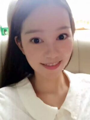 點陣激光祛痘后果對比圖，皮膚光滑多了