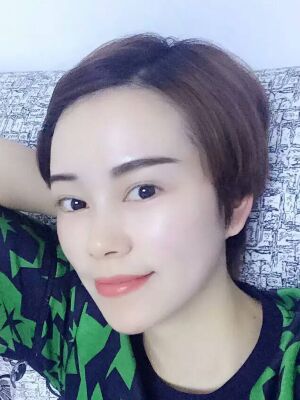 點陣激光祛痘后果對比圖，皮膚光滑多了