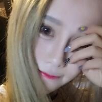 玻尿酸填充臥蠶果對(duì)比圖，很滿意