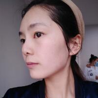 做完光子嫩膚恢復(fù)圖片和過程分享，光子嫩膚價(jià)格3800元