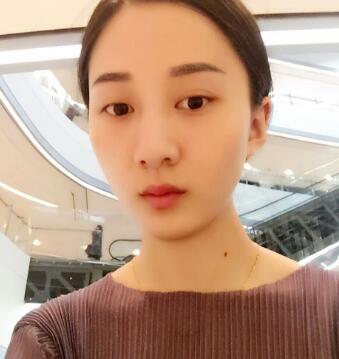 有誰(shuí)做過(guò)激光祛雀斑？個(gè)人激光祛雀斑后恢復(fù)日記分享