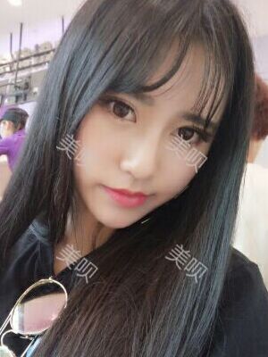 線D隆鼻恢復(fù)過程圖片，真實(shí)案例照片