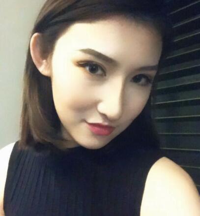 隆鼻失敗修復(fù)后恢復(fù)圖分享，鼻子修復(fù)價(jià)格9800元