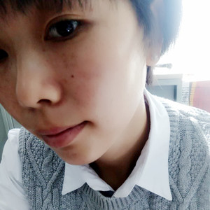 激光祛曬斑真實案例分享，并附上前后對比圖片