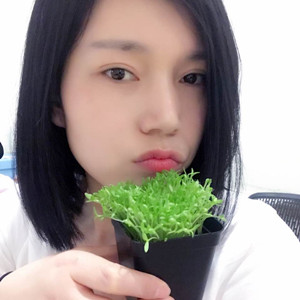 激光祛眼袋手術真實案例——邯鄲雅乾劉紅艷醫(yī)生做的