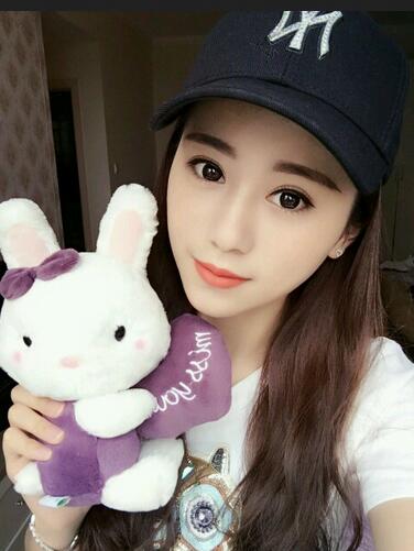 割雙眼皮案例圖片 雙眼皮手術(shù)20天