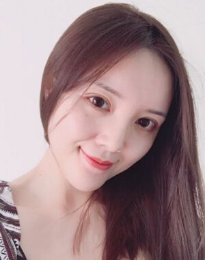 全切雙眼皮+硅膠墊下巴真實案例對比圖