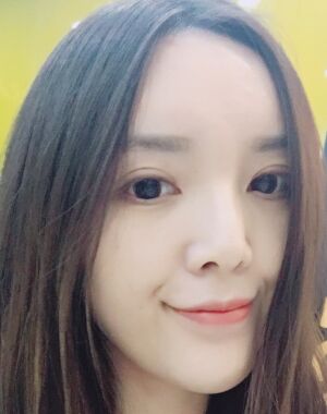 全切雙眼皮+硅膠墊下巴真實案例對比圖