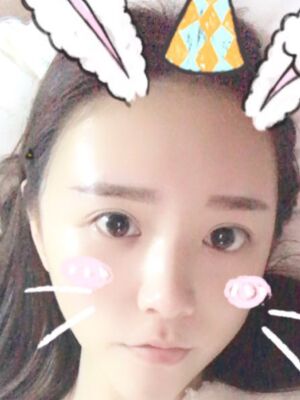 自體脂肪詳細部填充日記，恢復(fù)過程分享