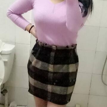 吸脂減肥瘦腰腹不反彈，恢復(fù)過程圖分享