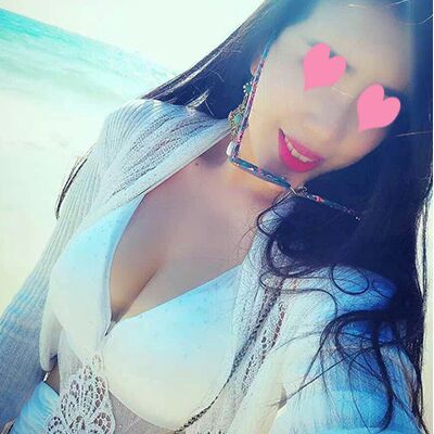 自體脂肪豐胸對(duì)比照片，福州愛美爾張勝利做的