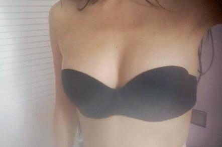 自體脂肪移植隆胸果圖分享，吸脂隆胸價(jià)格18800元