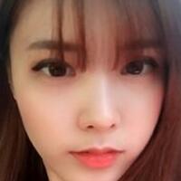 做了割雙眼皮和開內(nèi)眼角雙眼皮多項整形整形手術(shù)，恢復(fù)圖片日志分享