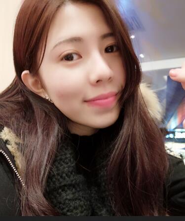 廣州凱美達(dá)微創(chuàng)雙眼皮手術(shù)恢復(fù)期紀(jì)實