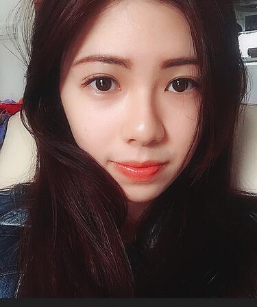 廣州凱美達(dá)微創(chuàng)雙眼皮手術(shù)恢復(fù)期紀(jì)實