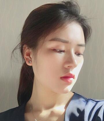 廣州凱美達(dá)皮膚美容激光祛斑前后對(duì)比