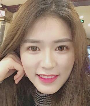 廣州凱美達(dá)皮膚美容激光祛斑前后對(duì)比