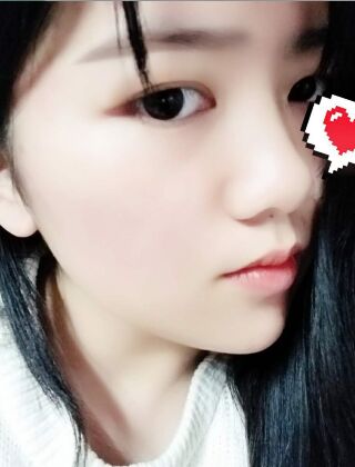 福州愛美爾黃振銀面部吸脂親身經(jīng)歷有圖