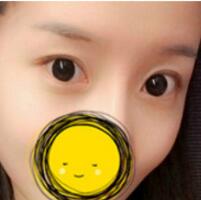 注射瘦臉去抬頭紋果不錯——濟南吉芙美容整形醫(yī)院