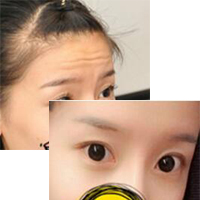 注射瘦臉去抬頭紋果不錯——濟南吉芙美容整形醫(yī)院